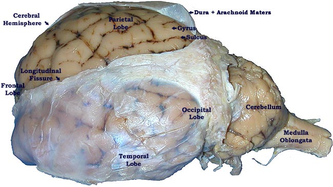 Pickled Sheep Brain-superficial superior view
