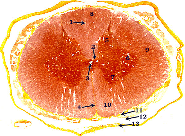 Spinal cord slide 2