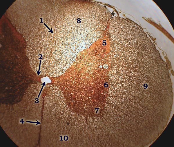 Spinal cord slide 1