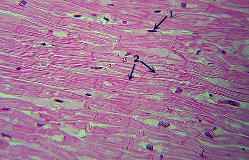 cardiac muscle slide