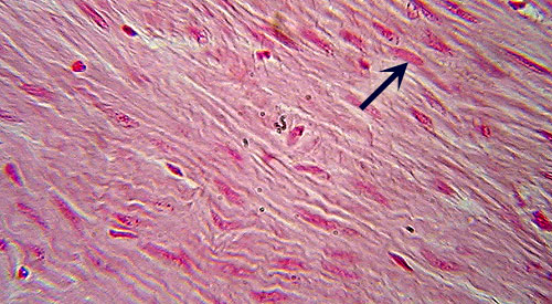 smooth muscle slide 1