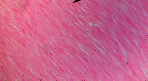 smooth muscle slide 2