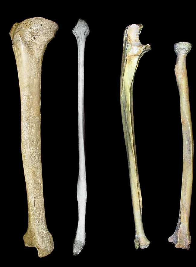 bones of the Distal limbs