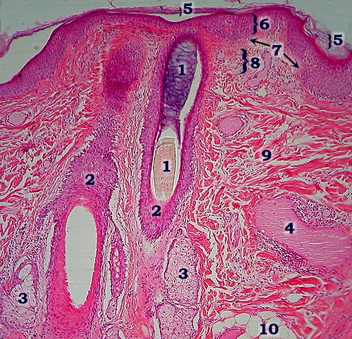 Skin Slide -- Sebaceous glands